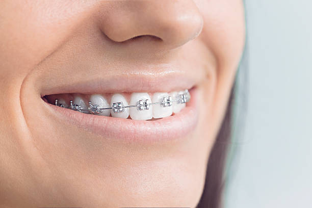 Best Veneers and Lumineers  in Selma, AL